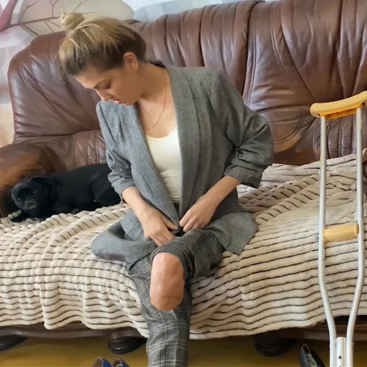 Amputee model Anna bath and walking video